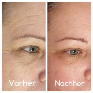 gesichtsbehandlung darmstadt